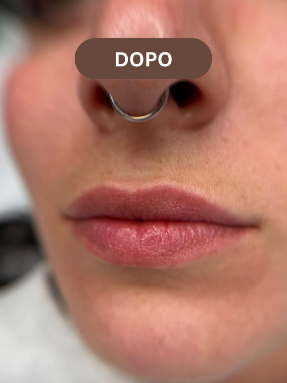 Lip Blush, foto del lavoro 2